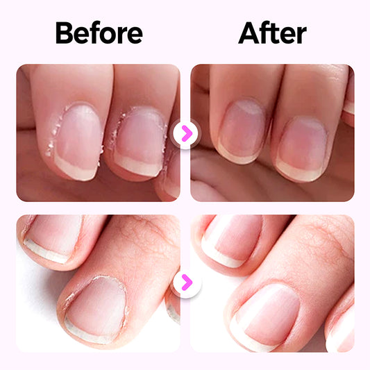 Exclusive Offer ✨New 3 in 1 nail care pen