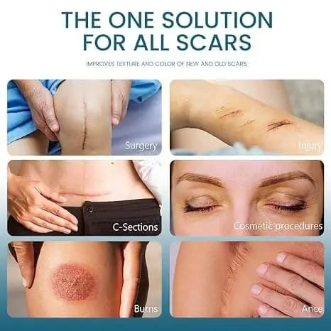 ✨Authentic Silicone Scar Removal Gel – Scar Care Treatment for Smoother-Looking Skin