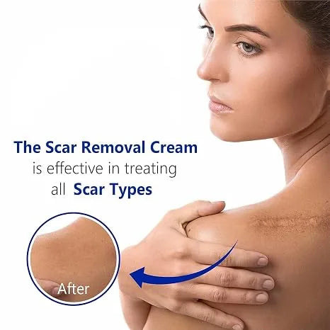 ✨Authentic Silicone Scar Removal Gel – Scar Care Treatment for Smoother-Looking Skin