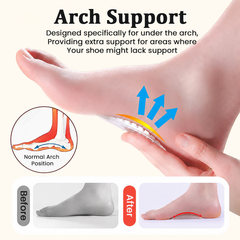 👣 Clear Silicone Arch Support Pads | Soft Gel Arch Cushions for Comfortable Walking ✨