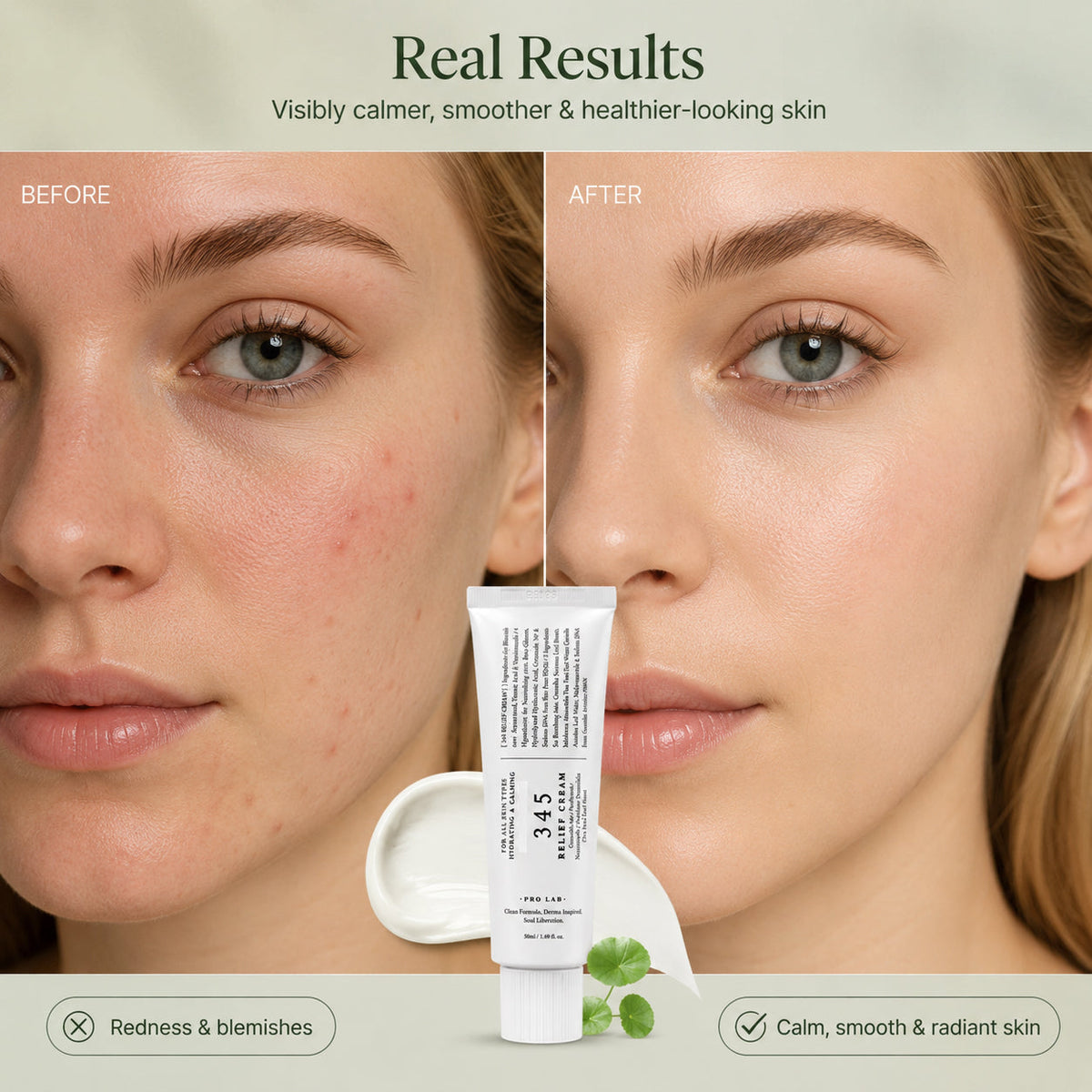 ( 🔥 HOT SALE- 50% OFF) 345 Relief Soothing Face Moisturizer