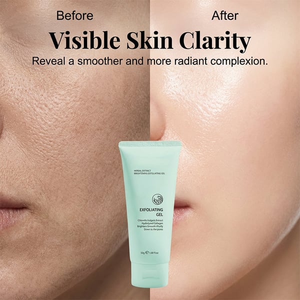🥳2026 HOT SALE🥳💞50K+ SOLD!💥🌸 Herbal Extract Brightening Exfoliating Gel