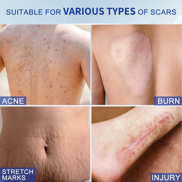 ✨Authentic Silicone Scar Removal Gel – Scar Care Treatment for Smoother-Looking Skin