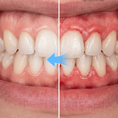 ✨🦷 Teeth Armour Brightening Serum